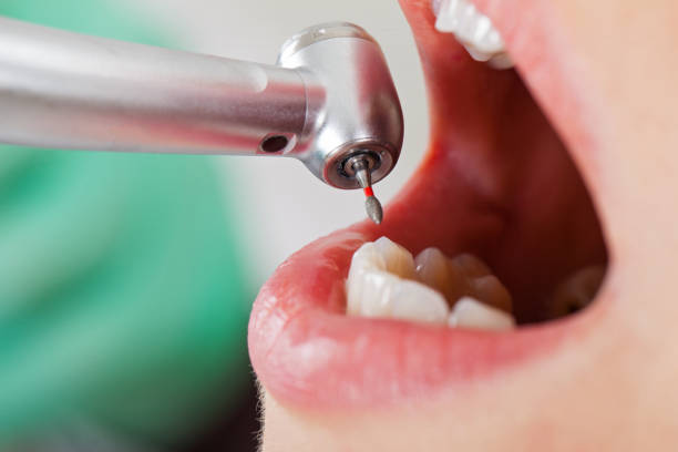 Best Broken Tooth Emergency  in Deerwood, TX